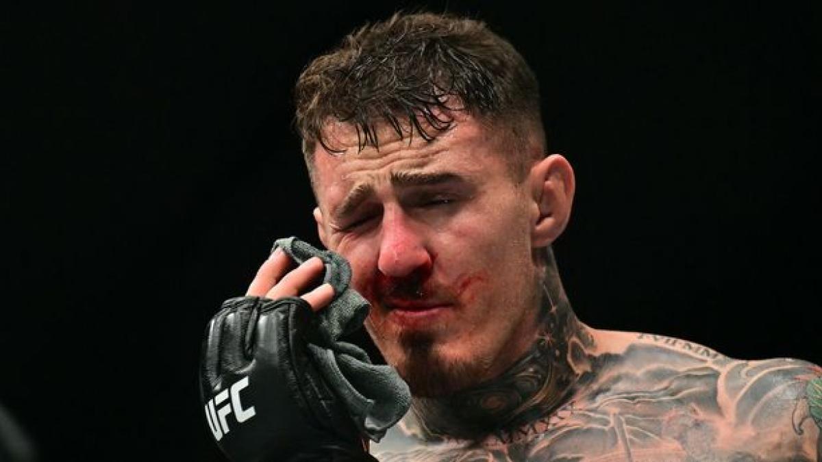 Tom Aspinall va révéler son état de santé suite à sa blessure aux yeux à l'UFC 321 dans les jours à venir !