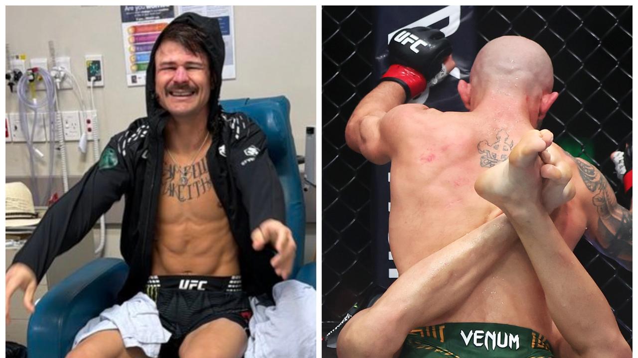 Diego Lopes révèle qu'il s'est fracturé les deux pieds lors de son combat contre Alexander Volkanovski : qui sera son prochain adversaire ? Vidéo, temps forts, réactions !