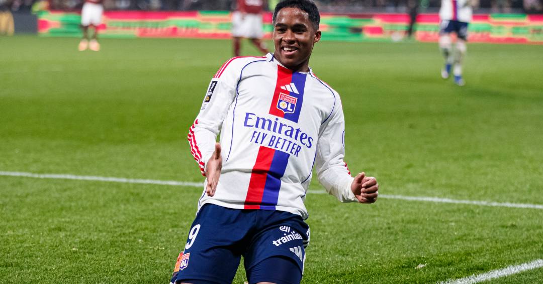 Lyon contre Lens en Coupe de France : Découvrez où regarder le match, à quelle heure et les équipes alignées !
