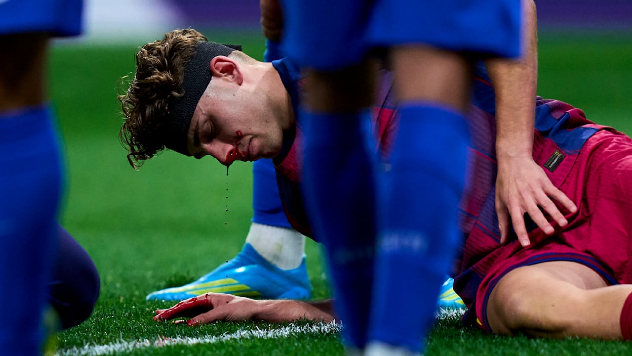 Champions League : Une star du Barça victime d'une hémorragie inquiétante !