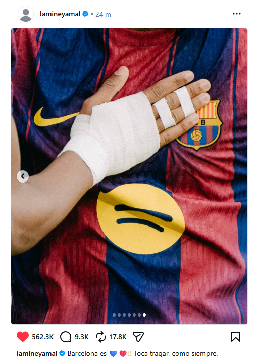 Le message de Lamine Yamal après le Barça-Espanyol